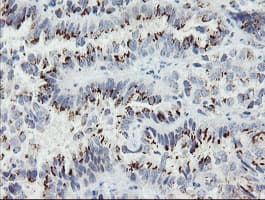 GCP60 / ACBD3 Antibody (clone OTI3E7)