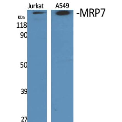 ABCC10 Antibody (810-890 aa, Internal)
