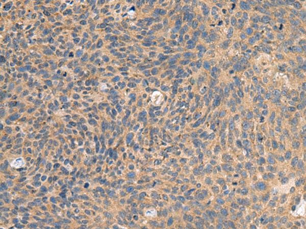 Polyclonal Rabbit anti-Human EIF1AX Antibody (IHC)