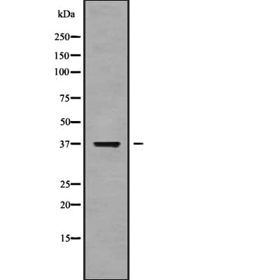 NEIL2 Antibody
