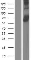 Human ACSF3 Protein (Over-Expression Lysate Myc-DDK (Flag))