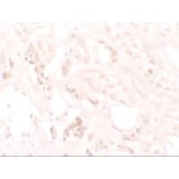 KANK3 Antibody