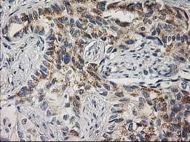 PLEKHA3 Antibody (clone OTI6E4)