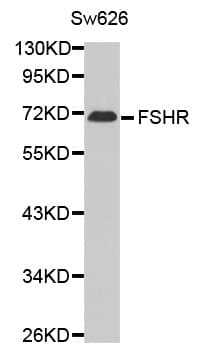 Polyclonal Rabbit anti-Human FSH Receptor / FSHR Antibody (IHC, WB)