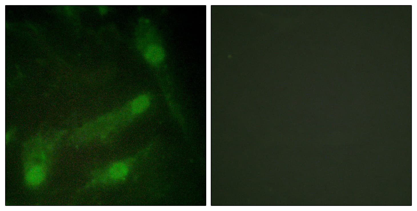 Polyclonal Rabbit anti-Human SMAD2 Antibody (phospho-Thr220, IF)
