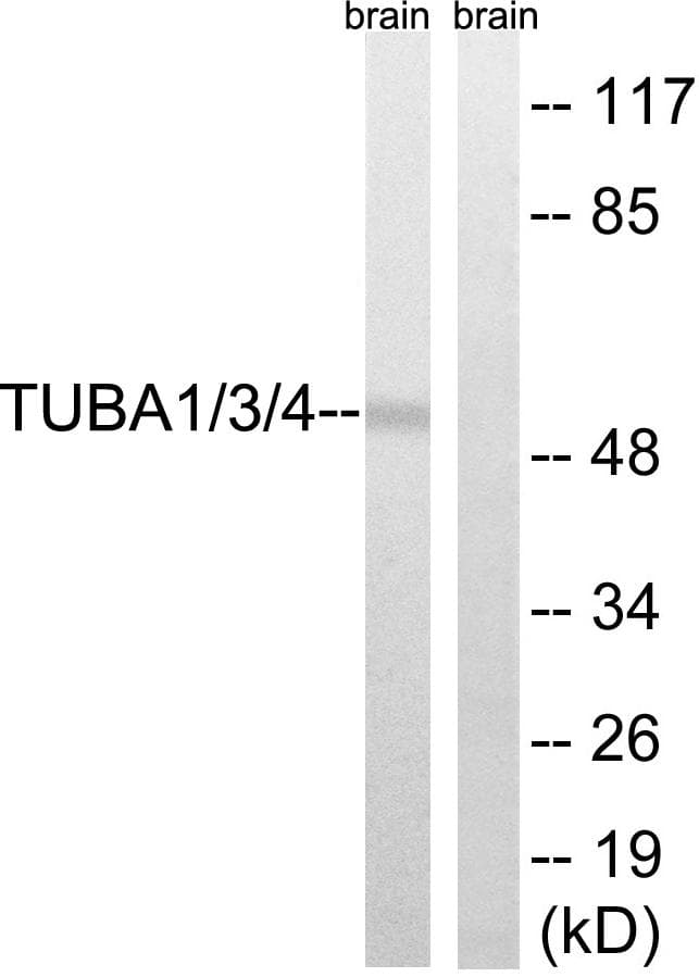TUBA1+3+4 Antibody (p272)