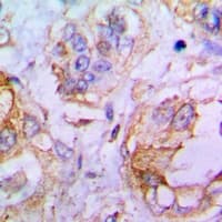 MARK1 / MARK Antibody