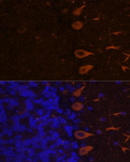 Polyclonal Rabbit anti-Human ANOS1 / Anosmin Antibody (IF)