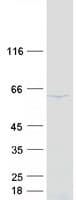 Human DDX56 Protein (Recombinant Myc-DDK (Flag))