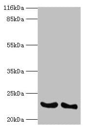 IFNA14 / Interferon Alpha 14 Antibody