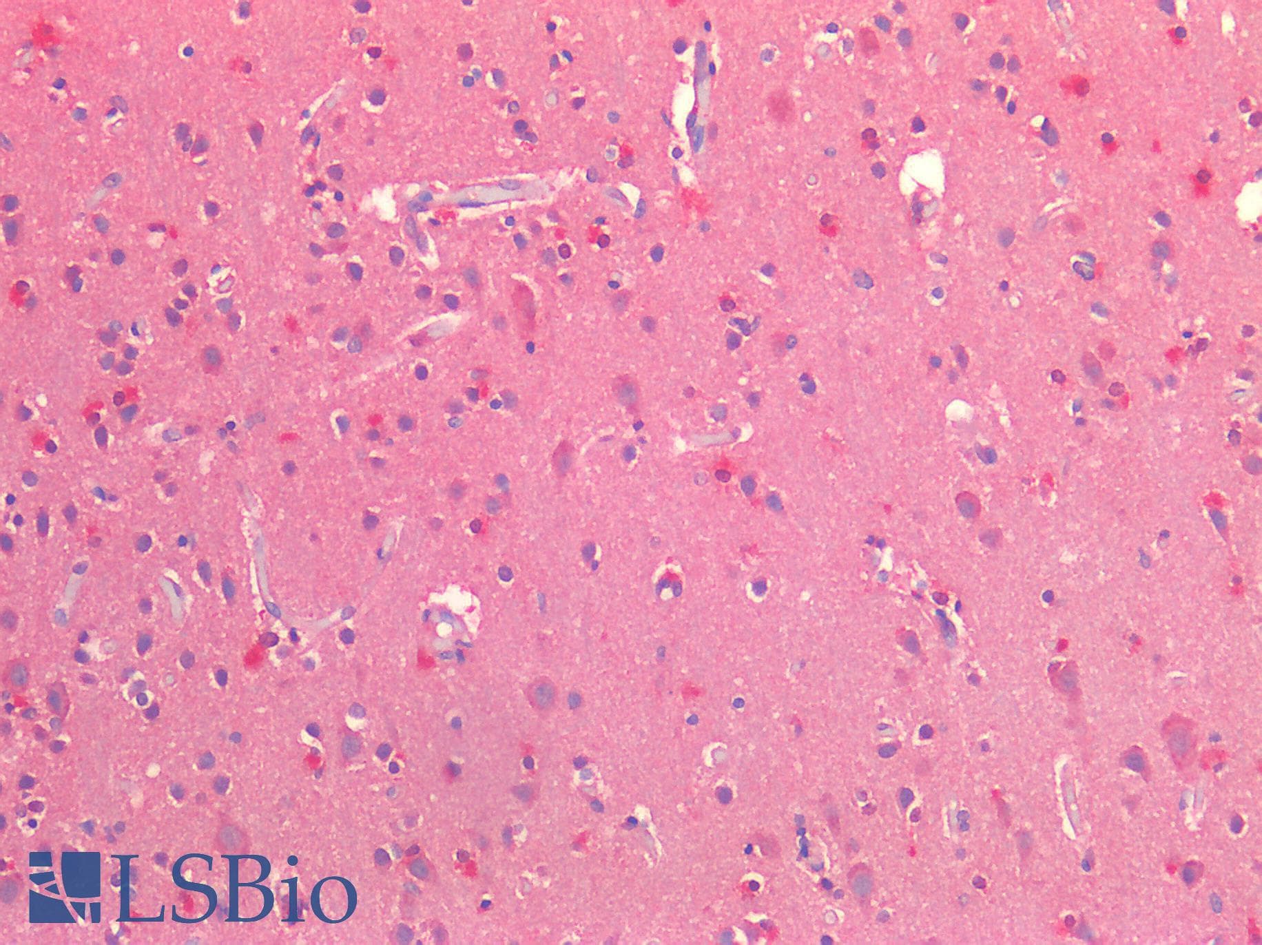 IHC-plus™ Polyclonal Rabbit anti-Human NRN1 / Neuritin Antibody (IHC)