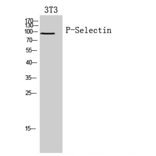 IHC-plus™ SELP / P-Selectin / CD62P Antibody (81-130 aa, N-terminal)