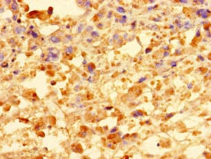 CCDC91 Antibody (Coiled-coil domain)