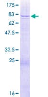 Human WDR13 Protein (Recombinant GST)