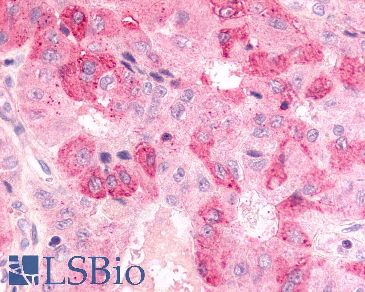 PathPlus™ Polyclonal Rabbit anti-Human BDKRB2/Bradykinin B2 Receptor Antibody (C-Terminus, IHC)