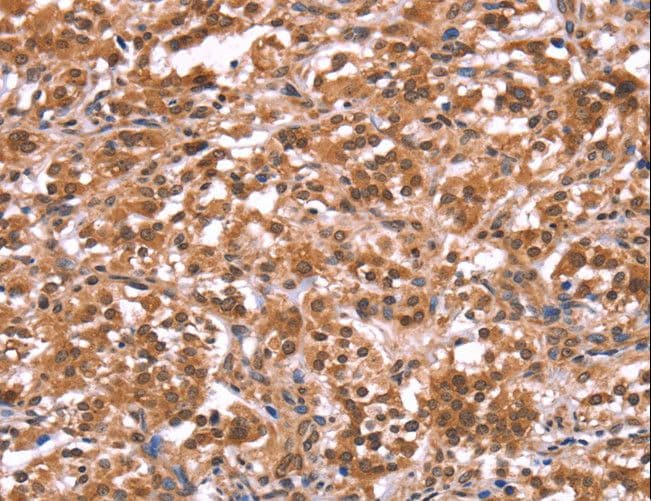 Polyclonal Rabbit anti-Human FAM123B / WTX Antibody (IHC)