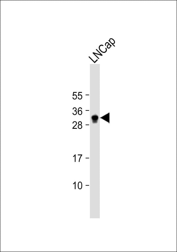 KLK3 / PSA Antibody