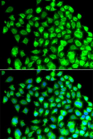 TBPL1 / TRF2 Antibody