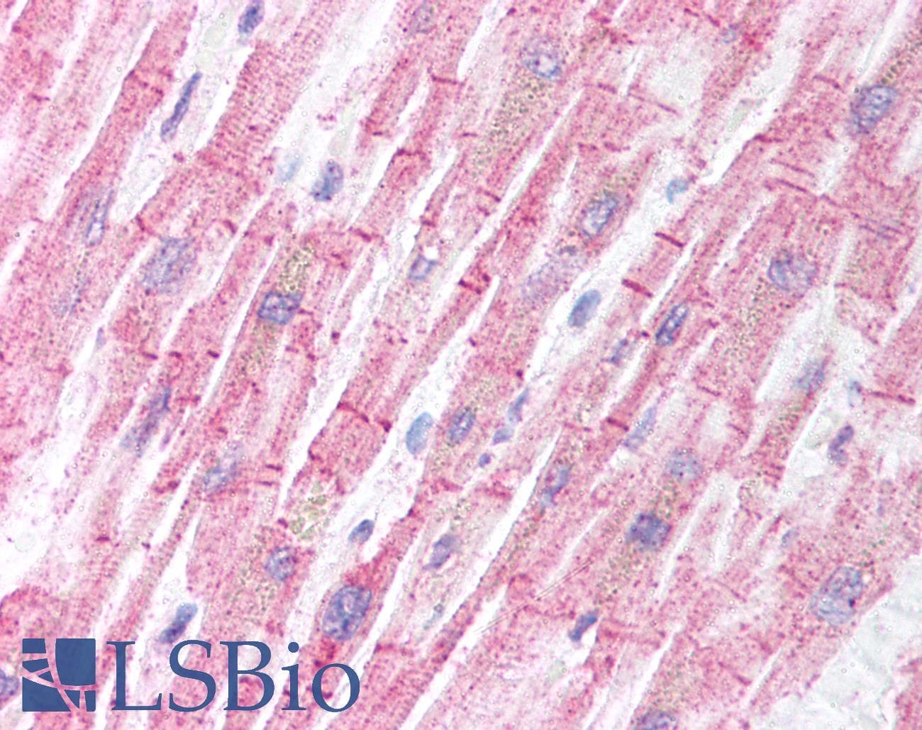 IHC-plus™ Polyclonal Rabbit anti-Human BCL2L11 / BIM Antibody (IHC, IF, WB)