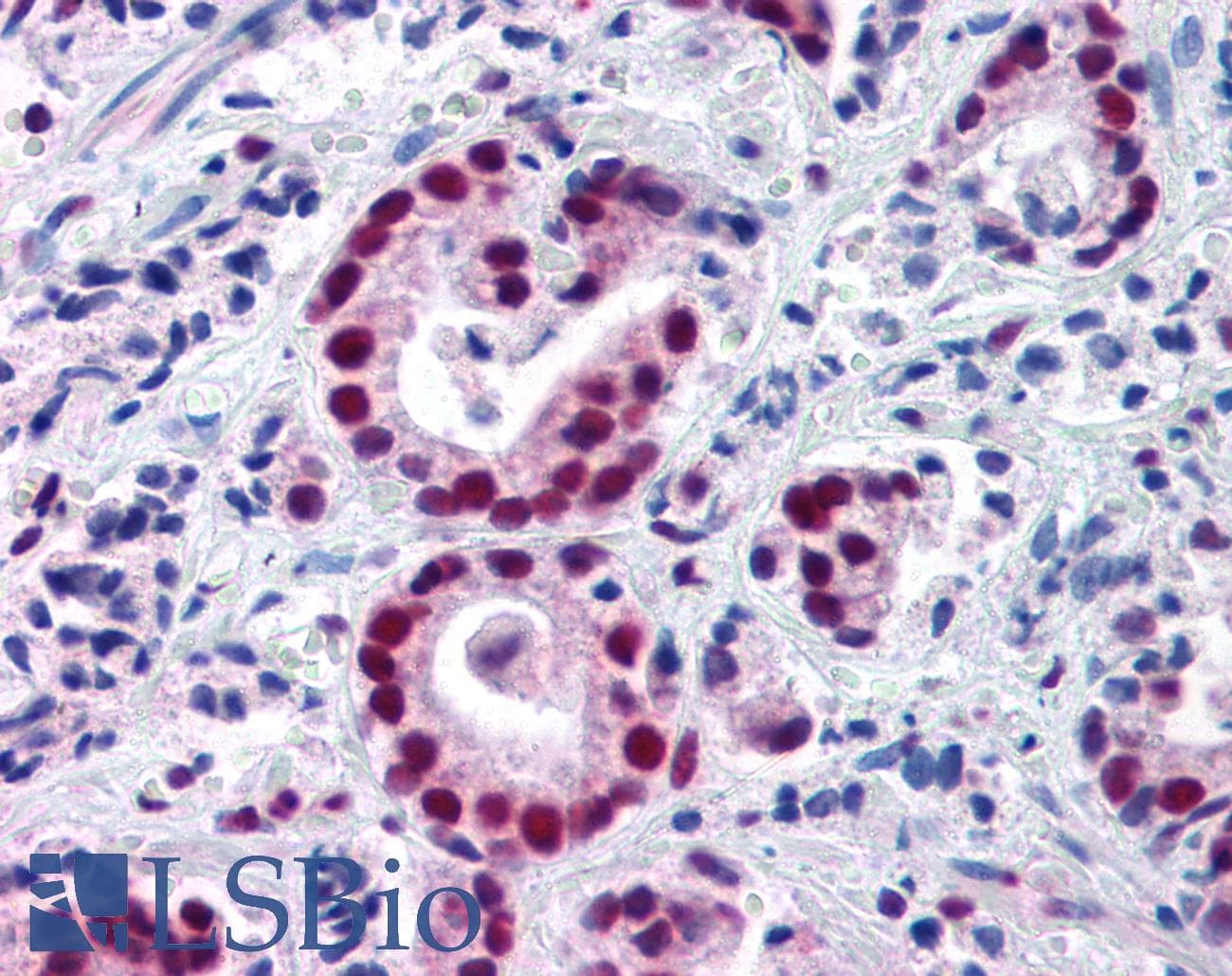 IHC-plus™ HDAC1 Antibody (aa450-482)