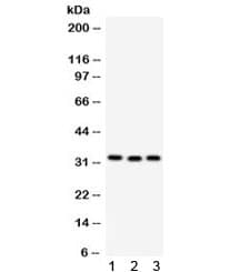 Polyclonal Rabbit anti-Human GC1qR / C1QBP Antibody (IHC, WB)