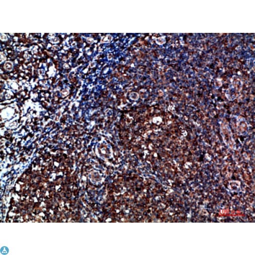 CYFIP2 / PIR121 Antibody
