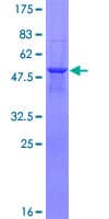 Human HDHD1 Protein (Recombinant GST)