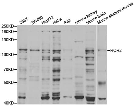 ROR2 Antibody