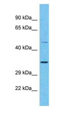 OR2A25 Antibody (C-Terminus)
