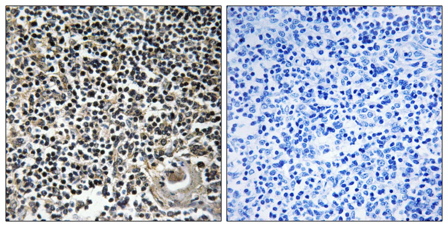 CBLN4 / Cerebellin 4 Antibody (aa141-190)