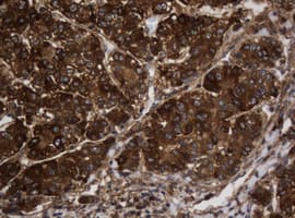 ASGR2 Antibody (clone OTI2A12)