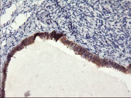 FBXO21 Antibody (clone OTI6C10)