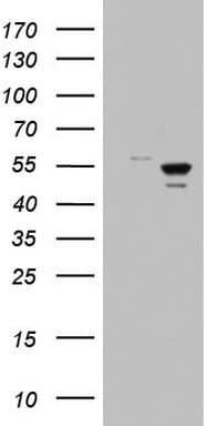 DDX6 Antibody (aa1-298, clone OTI3E2, Carrier-free)