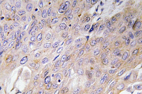 BMP3 Antibody (aa257-306)