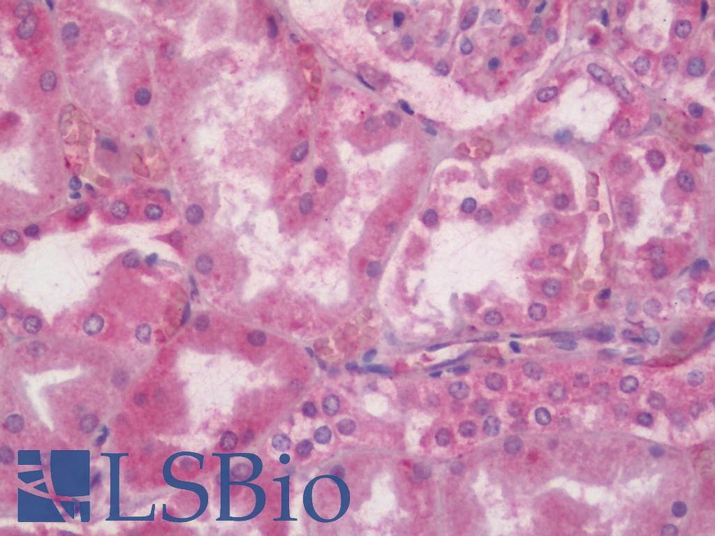 IHC-plus™ ITGAV/Integrin Alpha V/CD51 Antibody (aa755-804)