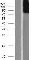 TSPYL2 / DENTT Protein (Over-Expression Lysate Myc-DDK (Flag))