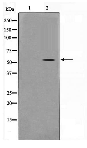 PFKFB1+4 Antibody