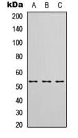 HIBADH Antibody (C-Terminus)