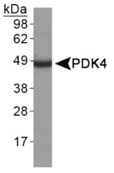 PDK4 Antibody (Internal)