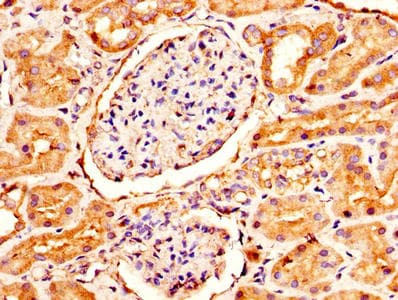 Polyclonal Rabbit anti-Human GUCA2B / Uroguanylin Antibody (aa37-112, IHC)