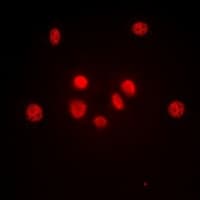 JUN / c-Jun Antibody (Internal)