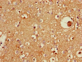 SPG15 / ZFYVE26 Antibody