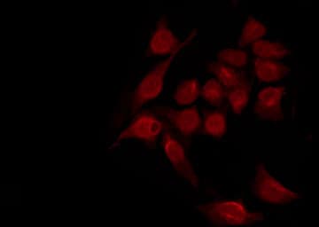 Polyclonal Rabbit anti-Human STAT2 Antibody (phospho-Tyr690, IHC, IF, WB)