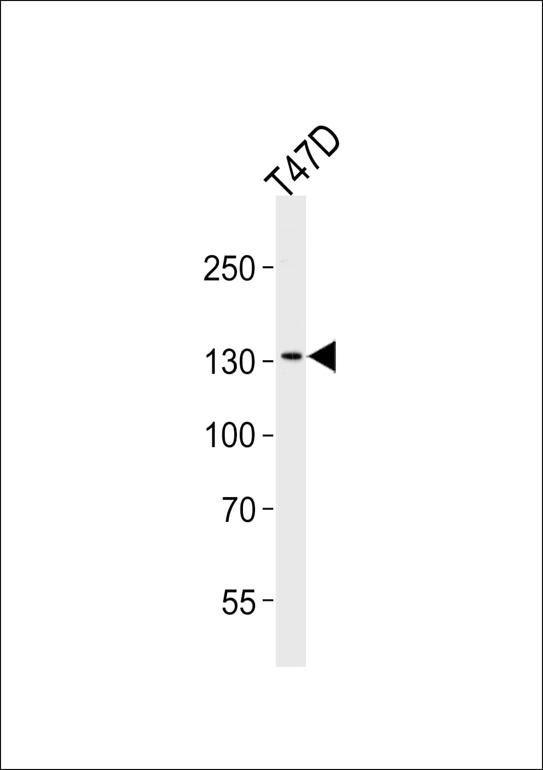 ATAD2 Antibody (aa204-232)