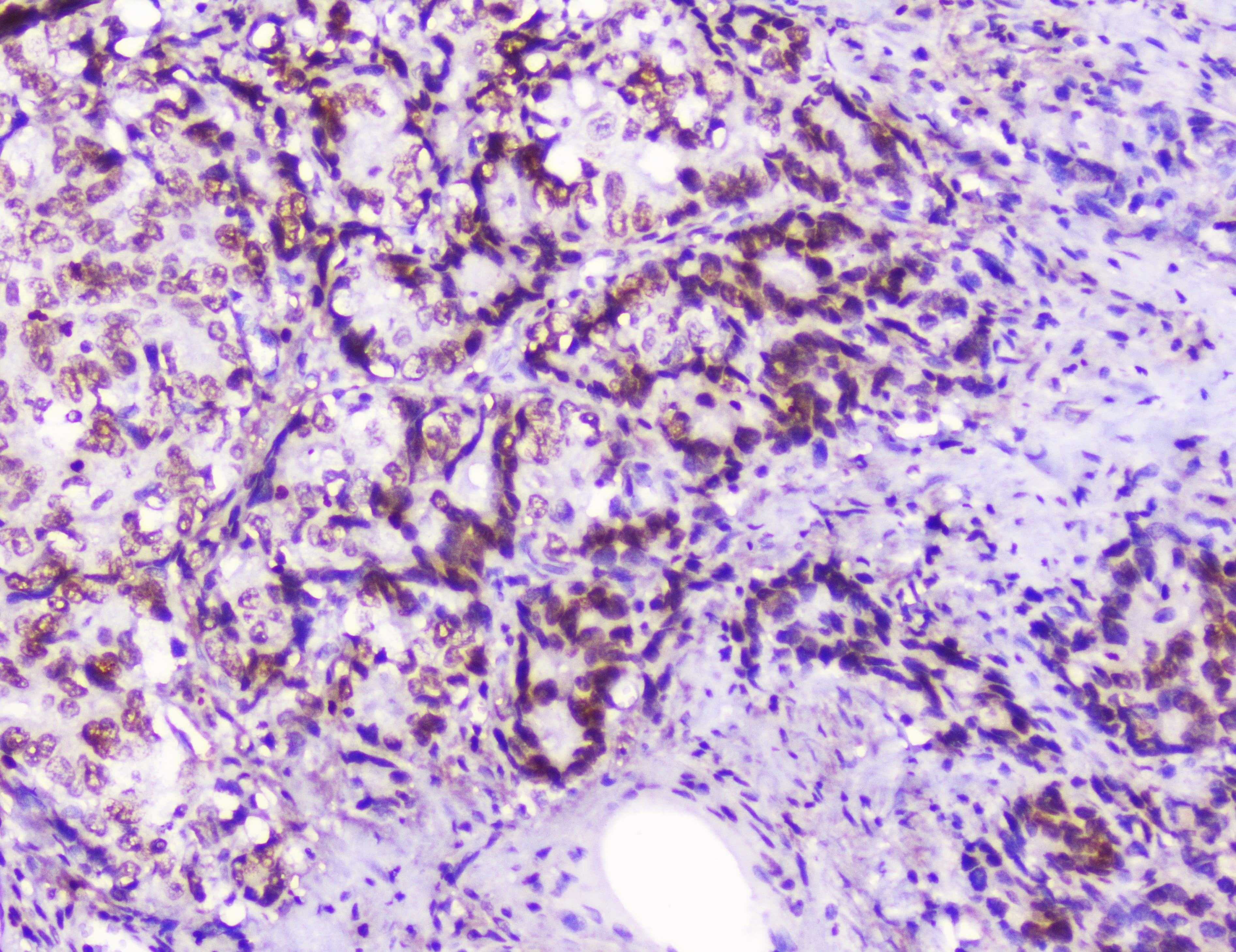 HMGN2 Antibody
