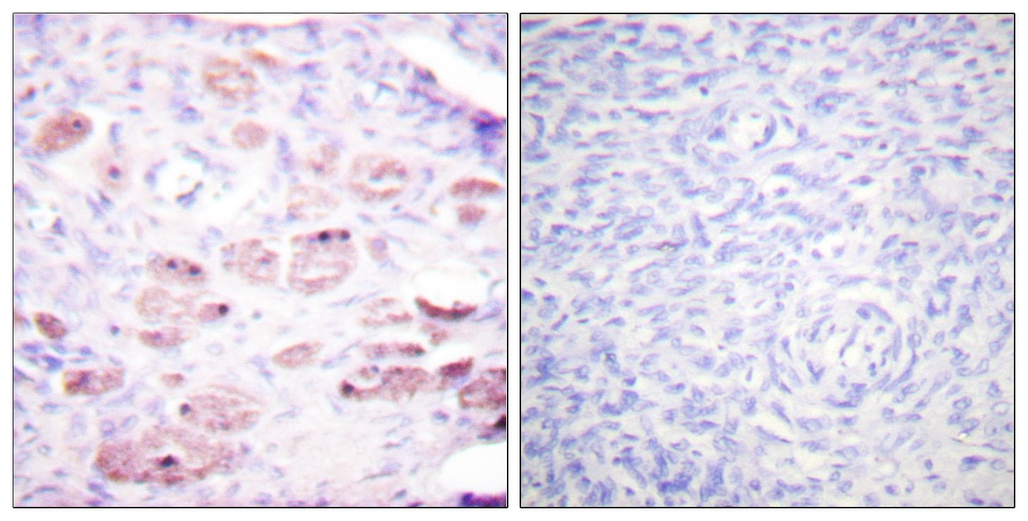 Polyclonal Rabbit anti-Human DAXX Antibody (phospho-Ser668, IHC, WB)