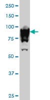 UBTF / UBF Antibody (clone 6B6)