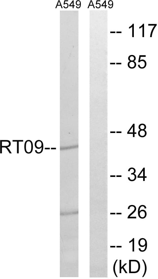 IHC-plus™ MRPS9 Antibody (aa91-140)