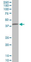 PPP1R8 / Rnase E Antibody (clone 1G11)