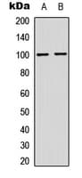 Polyclonal Rabbit anti-Human NFKB2 Antibody (C-Terminus, IHC, IF, WB)
